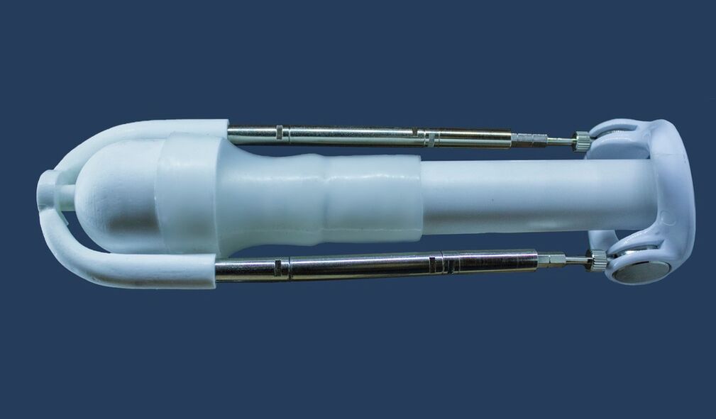Un extensor é un dispositivo que alonga o pene dun home.