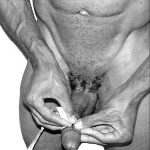 Medición do pene antes da ampliación