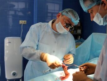 Cirurxía de ampliación do pene realizada por un cirurxián